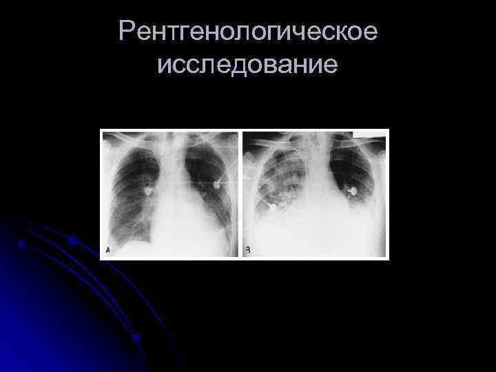 Рентгенологическое исследование 