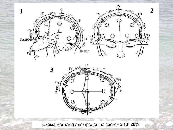 Схема монтажа электродов по системе 10– 20%. 