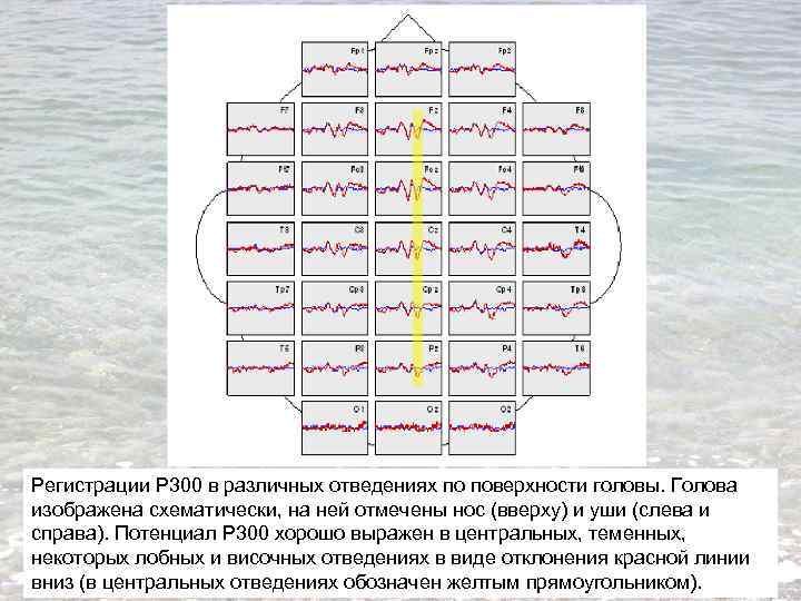 Регистрации Р 300 в различных отведениях по поверхности головы. Голова изображена схематически, на ней