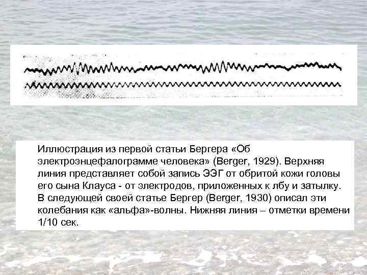 Иллюстрация из первой статьи Бергера «Об электроэнцефалограмме человека» (Berger, 1929). Верхняя линия представляет собой