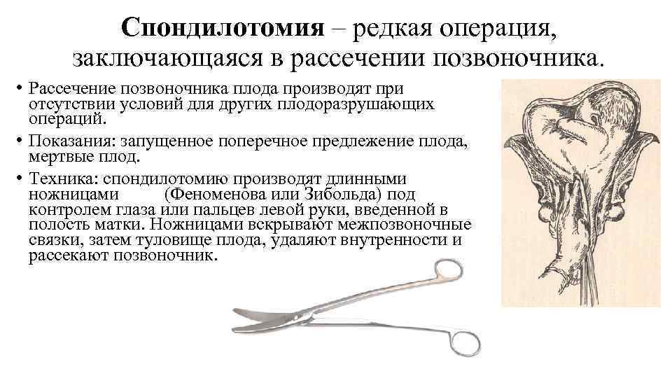 Спондилотомия – редкая операция, заключающаяся в рассечении позвоночника. • Рассечение позвоночника плода производят при