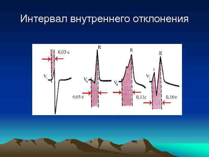 Интервал внутреннего отклонения 