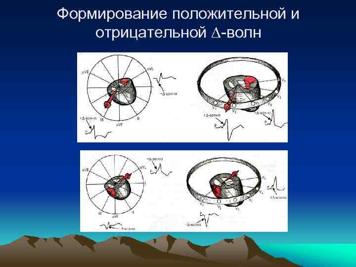 Формирование положительной и отрицательной ∆-волн 
