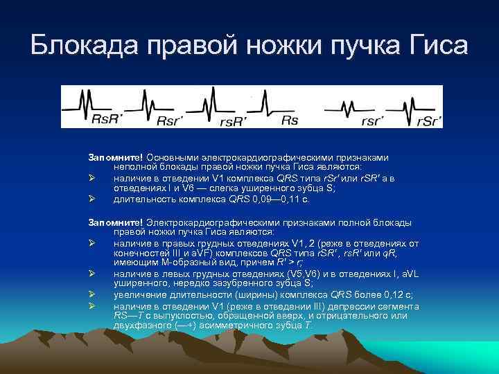 Блокада правой ножки пучка Гиса Запомните! Основными электрокардиографическими признаками неполной блокады правой ножки пучка