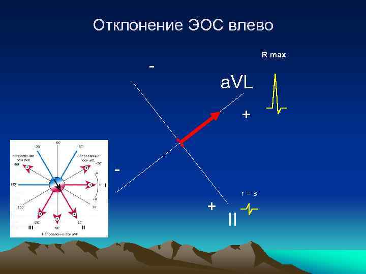 Отклонение ЭОС влево R max - a. VL + r=s + II 