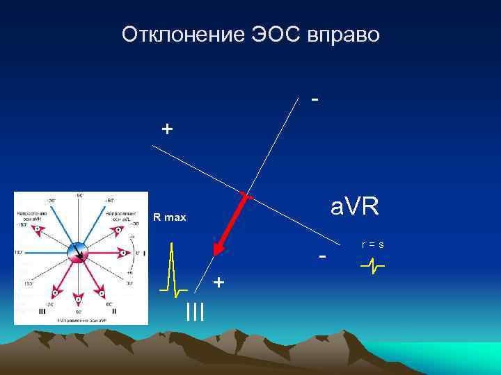Отклонение ЭОС вправо + a. VR R max + III r=s 