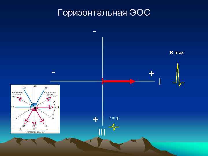 Вертикальная эос. Шестиосевая система координат по Бейли. Система координат Бейли ЭКГ. Электрическая ось Бейли. 6 Осевая система координат Бейли.