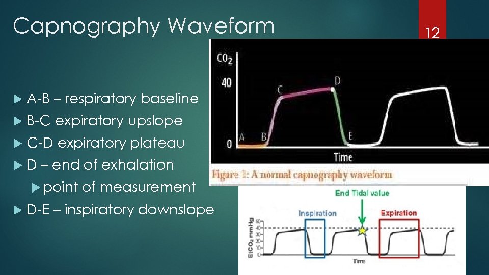 Capnography Waveform A-B – respiratory baseline B-C expiratory upslope C-D expiratory plateau D –