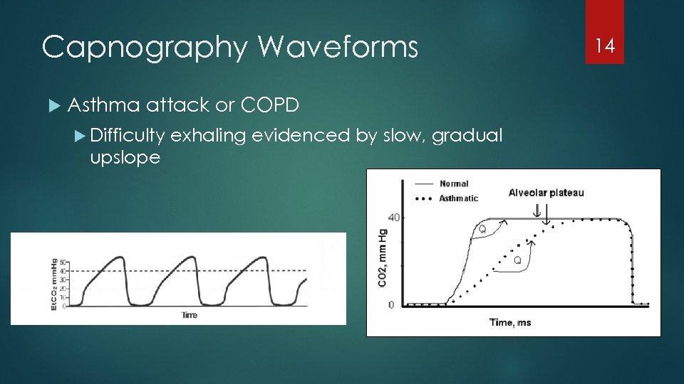 Capnography Waveforms Asthma attack or COPD Difficulty upslope exhaling evidenced by slow, gradual 14