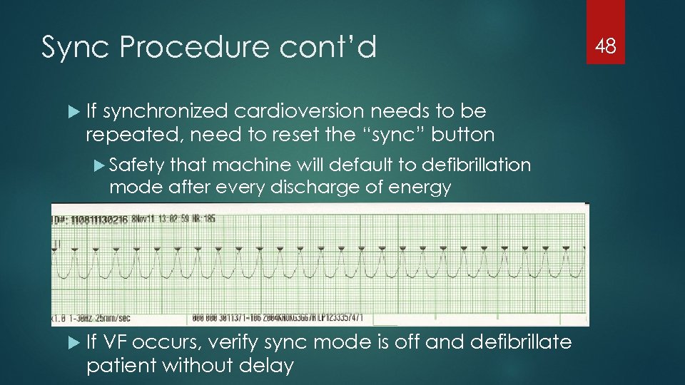Sync Procedure cont’d If synchronized cardioversion needs to be repeated, need to reset the