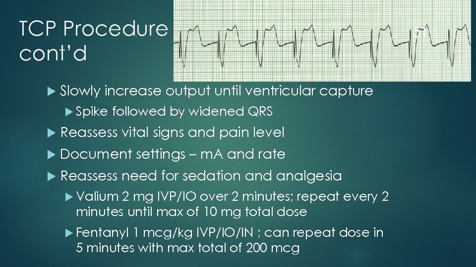 TCP Procedure cont’d Slowly increase output until ventricular capture Spike followed by widened QRS