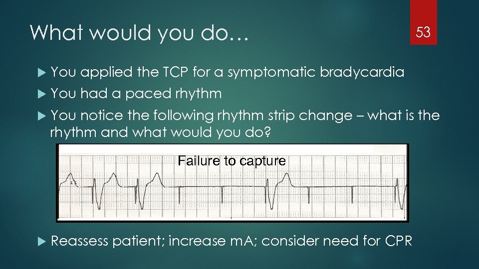 What would you do… 53 You applied the TCP for a symptomatic bradycardia You