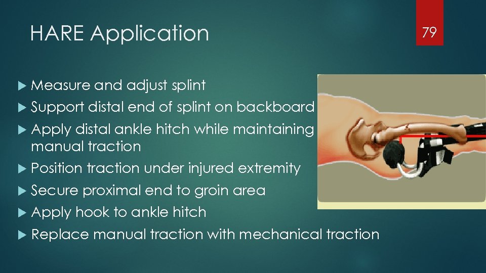 HARE Application Measure and adjust splint Support distal end of splint on backboard Apply