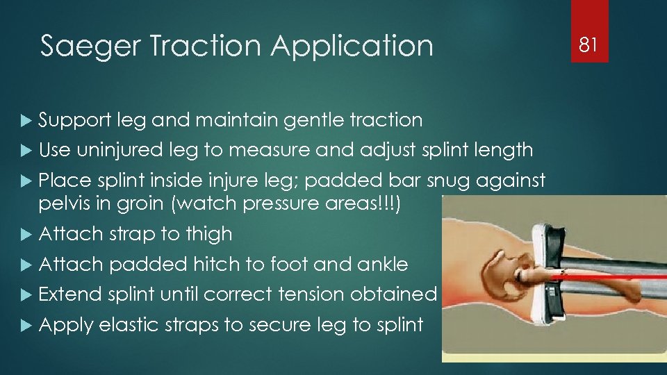 Saeger Traction Application Support leg and maintain gentle traction Use uninjured leg to measure