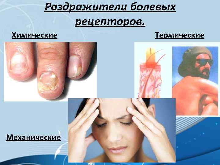 Раздражители болевых рецепторов. Химические Механические Термические 