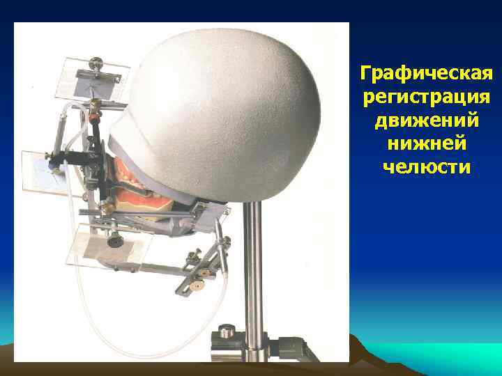 Графическая регистрация движений нижней челюсти 