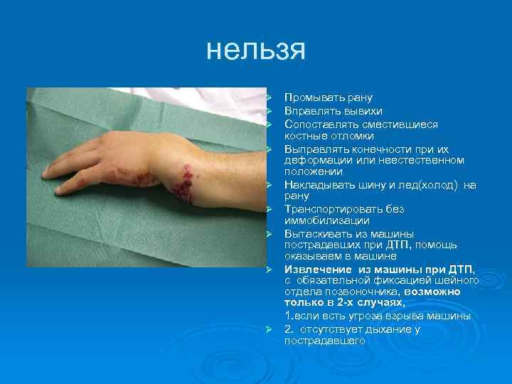 нельзя Ø Ø Ø Ø Ø Промывать рану Вправлять вывихи Сопоставлять сместившиеся костные отломки