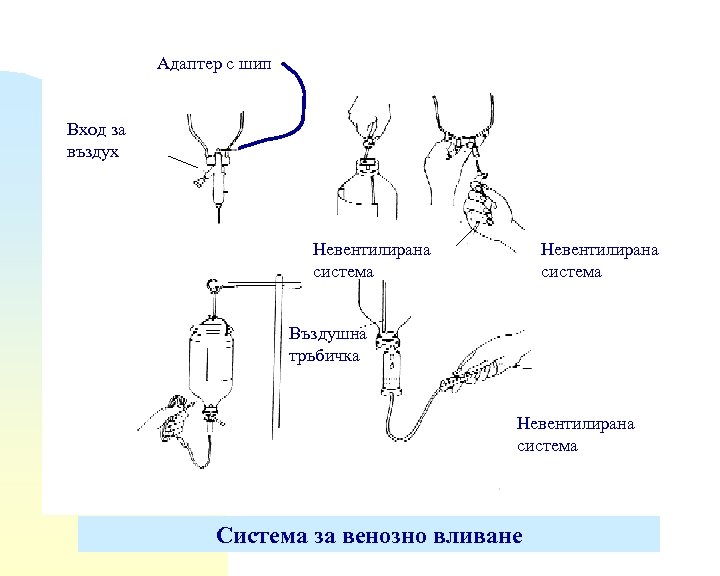 Адаптер с шип Вход за въздух Невентилирана система Въздушна тръбичка Невентилирана система Система за