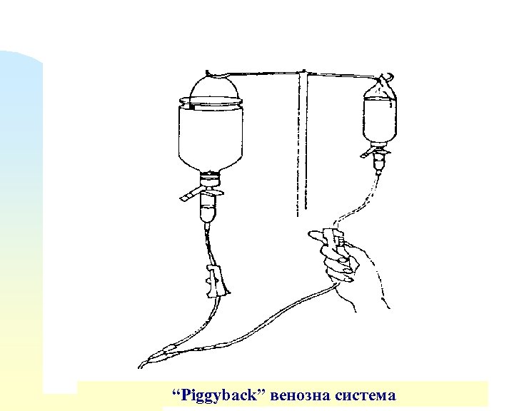 “Piggyback” венозна система 