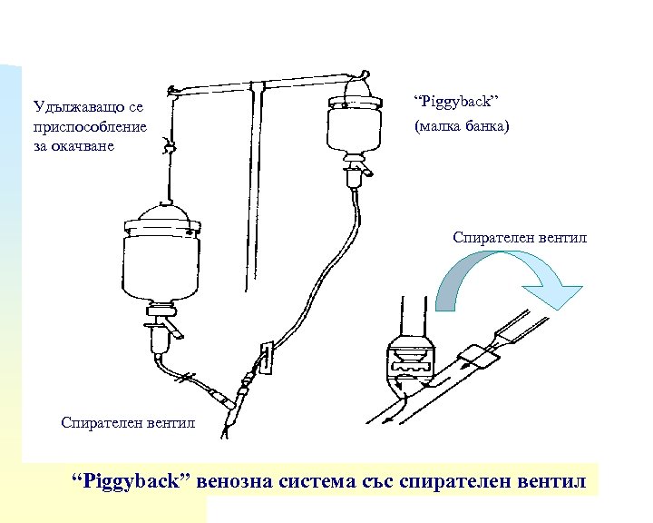 Удължаващо се приспособление за окачване “Piggyback” (малка банка) Спирателен вентил “Piggyback” венозна система със