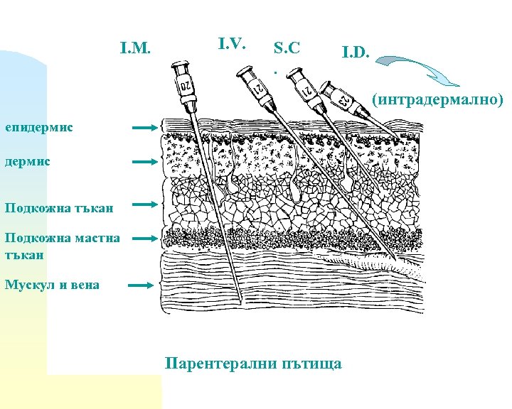 I. M. I. V. S. C. I. D. (интрадермално) епидермис Подкожна тъкан Подкожна мастна