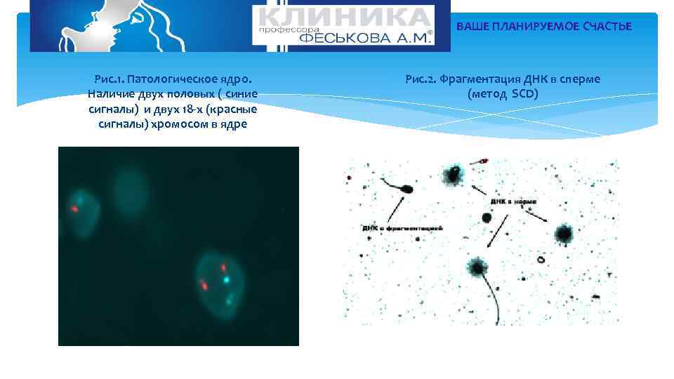 ВАШЕ ПЛАНИРУЕМОЕ СЧАСТЬЕ Рис. 1. Патологическое ядро. Наличие двух половых ( синие сигналы) и