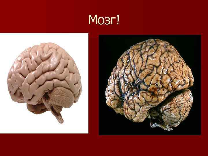 Мозг! 