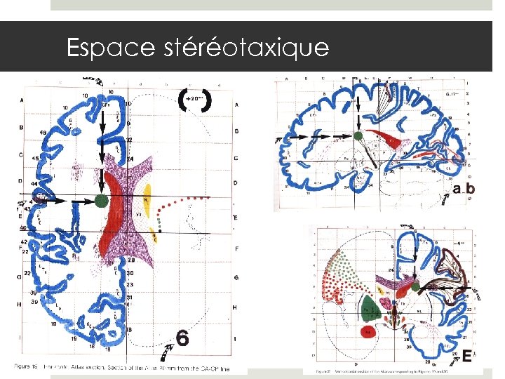 Espace stéréotaxique 