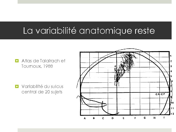 La variabilité anatomique reste Atlas de Talairach et Tournoux, 1988 Variabilité du sulcus central