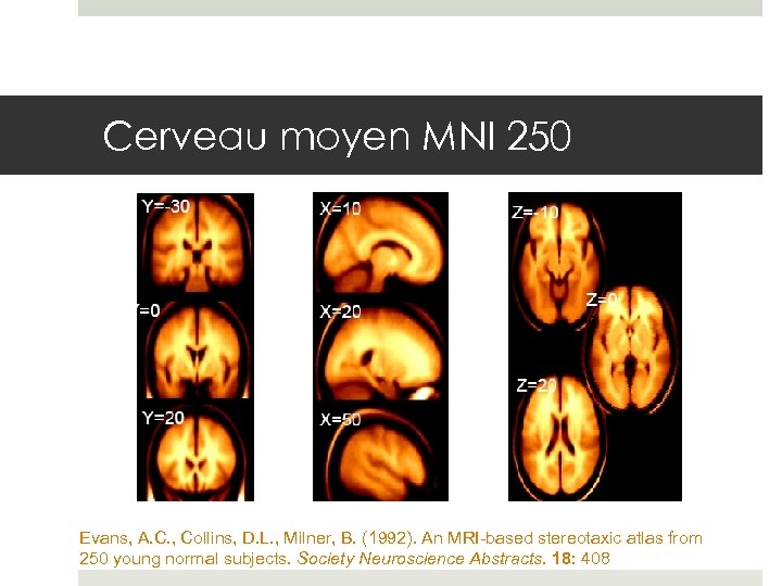 Cerveau moyen MNI 250 Evans, A. C. , Collins, D. L. , Milner, B.