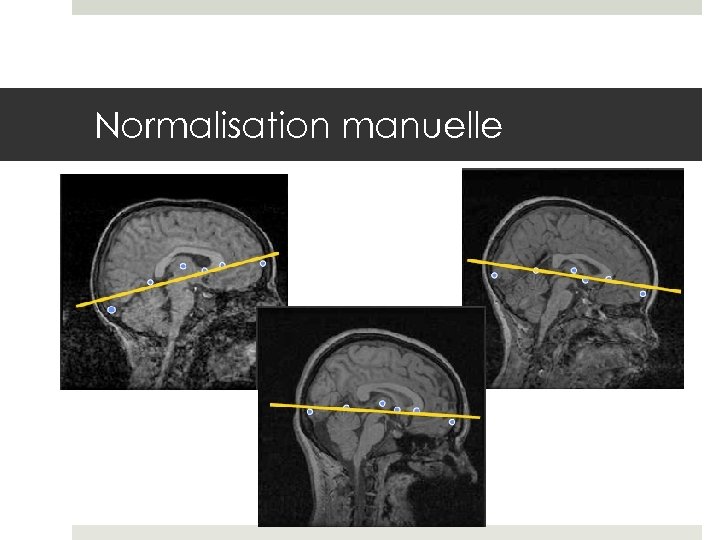 Normalisation manuelle 