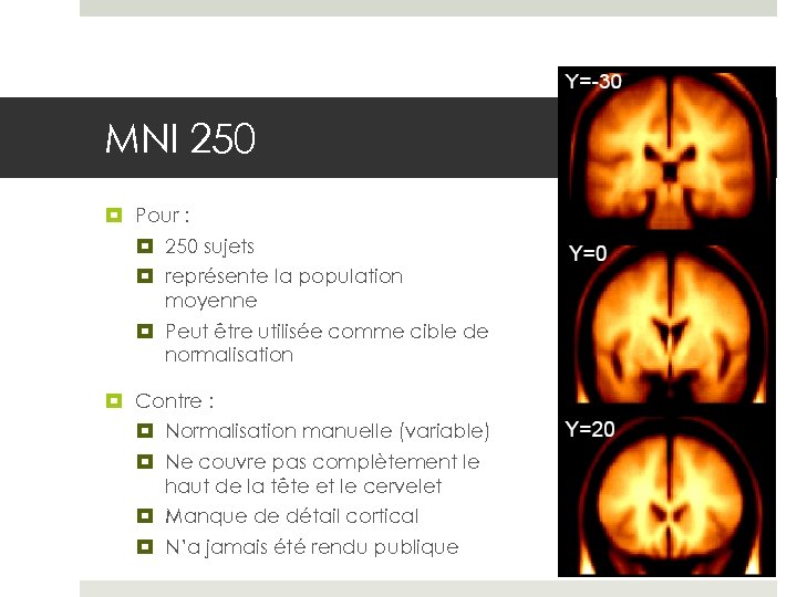 MNI 250 Pour : 250 sujets représente la population moyenne Peut être utilisée comme
