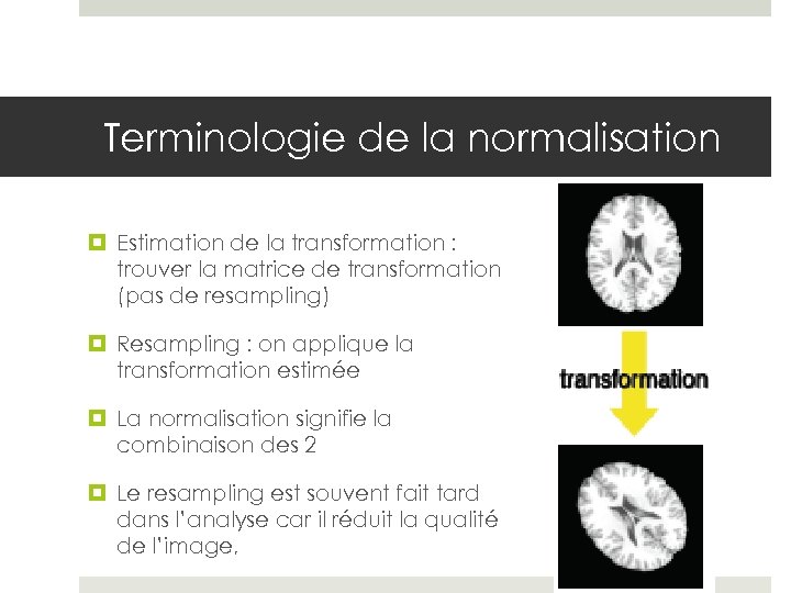 Terminologie de la normalisation Estimation de la transformation : trouver la matrice de transformation