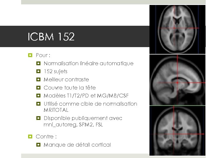 ICBM 152 Pour : Normalisation linéaire automatique 152 sujets Meilleur contraste Couvre toute la
