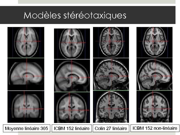 Modèles stéréotaxiques Moyenne linéaire 305 ICBM 152 linéaire Colin 27 linéaire ICBM 152 non-linéaire