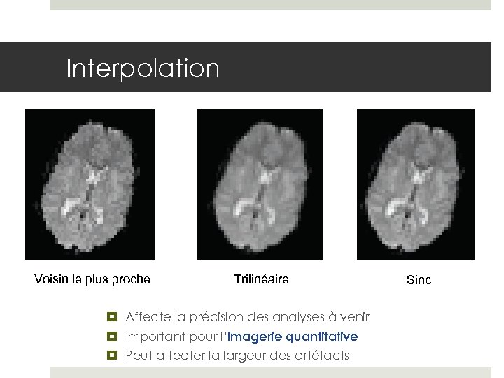 Interpolation Voisin le plus proche Trilinéaire Affecte la précision des analyses à venir Important