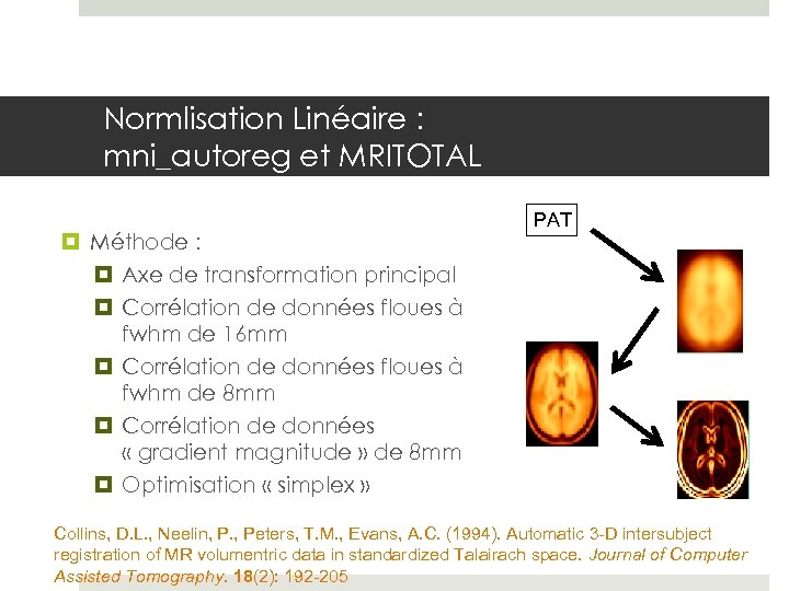Normlisation Linéaire : mni_autoreg et MRITOTAL Méthode : Axe de transformation principal Corrélation de