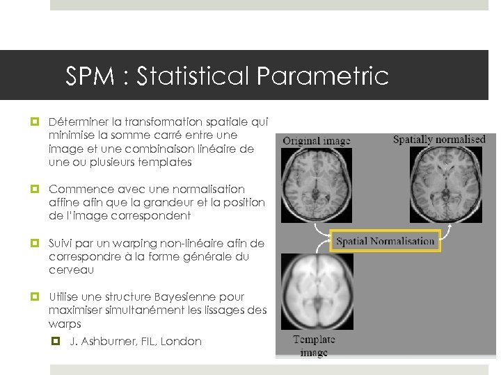 SPM : Statistical Parametric Déterminer la transformation spatiale qui minimise la somme carré entre