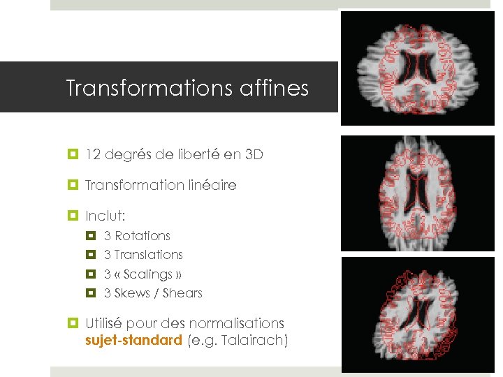 Transformations affines 12 degrés de liberté en 3 D Transformation linéaire Inclut: 3 Rotations