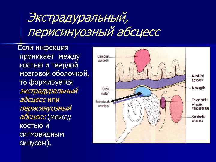 Паратанзиальная абсцесс карта вызова