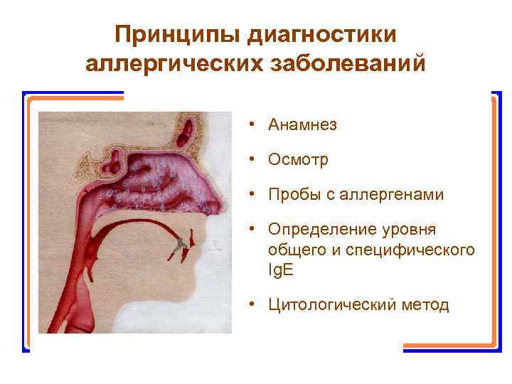 Принципы диагностики аллергических заболеваний