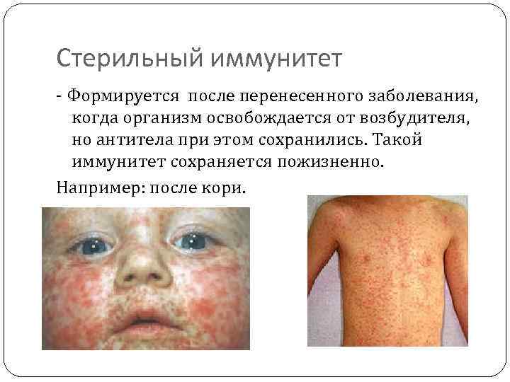 Стерильный иммунитет - Формируется после перенесенного заболевания, когда организм освобождается от возбудителя, но антитела