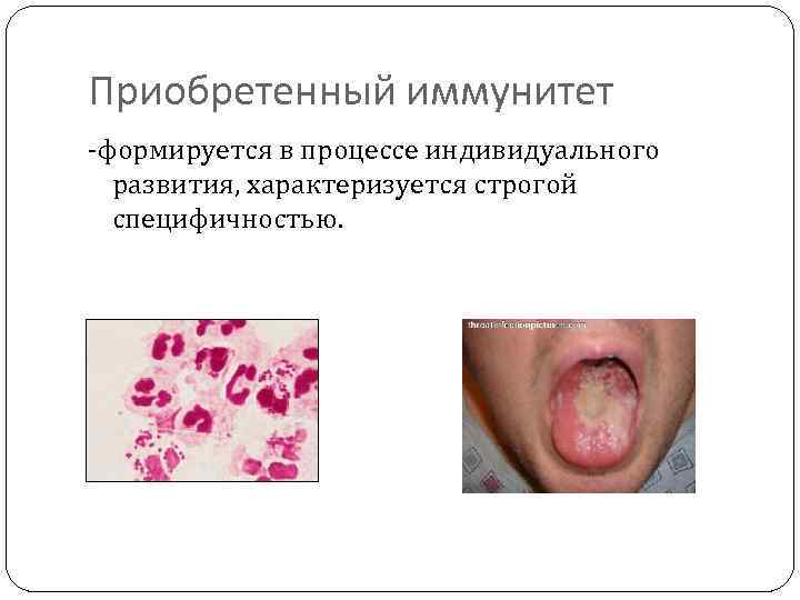 Приобретенный иммунитет -формируется в процессе индивидуального развития, характеризуется строгой специфичностью. 