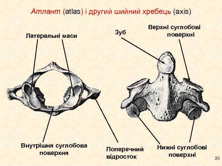 Атлант (atlas) і другий шийний хребець (axis) Латеральні маси Внутрішня суглобова поверхня Зуб Поперечний