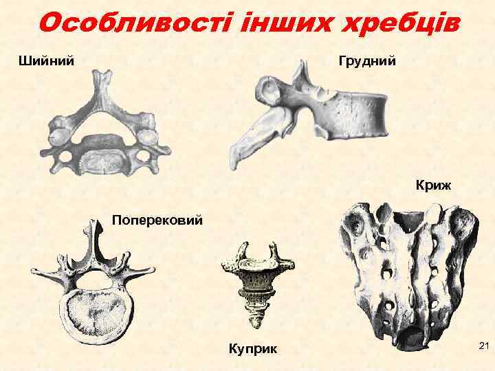 Особливості інших хребців Шийний Грудний Криж Поперековий Куприк 21 