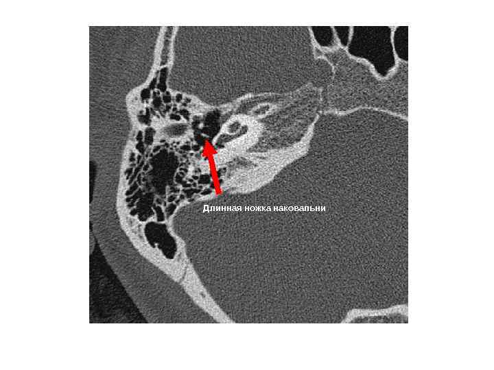 Длинная ножка наковальни 