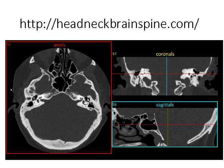 http: //headneckbrainspine. com/ 