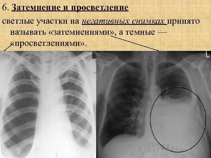 Рентгеновское изображение получают в результате неоднородного