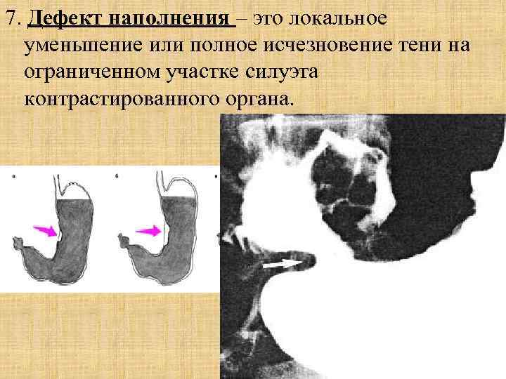 Введение в лучевую диагностику презентация