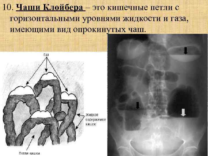 Введение в лучевую диагностику презентация